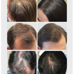 Hair Care Hair Growth Essential Oils Essence Original Authentic 100% Hair Loss Liquid Health Care Beauty Dense Hair Growth Serum DR. KILL PAIN: Hair Growth Oil  Hair Care NEW Uncategorized