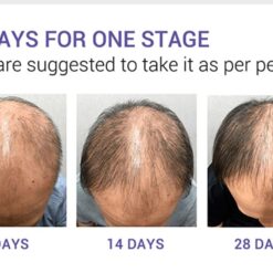 Hair Care Hair Growth Essential Oils Essence Original Authentic 100% Hair Loss Liquid Health Care Beauty Dense Hair Growth Serum DR. KILL PAIN: Hair Growth Oil  Hair Care NEW Uncategorized