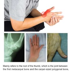 VELPEAU CMC Thumb Orthosis Relieves Arthritis Pain At The Bottom of Thumb Lightweight and Breathable Support Brace With Sleeve color: LEFT|RIGHT  New Arrivals Uncategorized Best Sellers