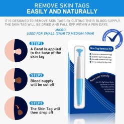 LESCOLTON Auto Skin Tag Remover Painless Mole Wart Remover Skin Tag Removal Kit with Cleansing Swabs Facial Beauty Tool Home Use color: 40 Bands|60 Bands|80 Bands  New Arrivals Uncategorized Skin Care Best Sellers