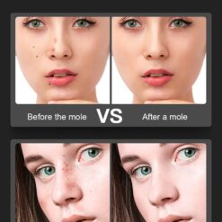 Laser Plasma Pen for Skin Tag Remover Freckle Black Dot Papilloma Warts Mole Pimples Tattoo Removal Laser Pen Beauty Care Tools color: SP1923-GD|SP1923-GD-6|SP1923-PK|SP1923-PK-6|SP1923-WH|SP1923-WH-6  New Arrivals Uncategorized Skin Care Best Sellers