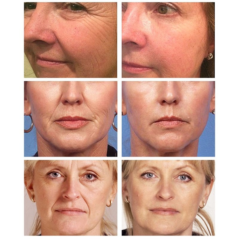 Peptide Wrinkle Remover Face Cream Anti Aging Firming Lifting Facial Products Fade Fine Lines Whitening Moisturizing Beauty Care